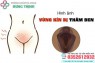 22 Hình ảnh cô bé bị thâm đen và cách khắc phục