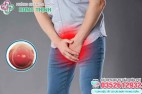 Lỗ sáo bị sưng đỏ là dấu hiệu bệnh gì, cách chữa