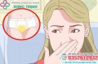 Tại sao đáy quần lót có màu vàng? Khí hư làm vàng quần lót?