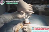 Chi phí cắt bao quy đầu ở Hà Nội hết bao nhiêu tiền