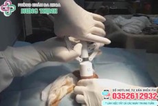 Chi phí cắt bao quy đầu ở Hà Nội hết bao nhiêu tiền