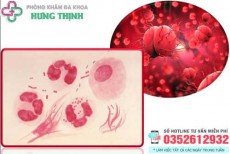 Chi phí chữa bệnh lậu hết bao nhiêu tiền?