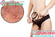 Vùng kín bị nổi hạt trắng, đỏ, nhỏ ngứa đau rát là bệnh gì?