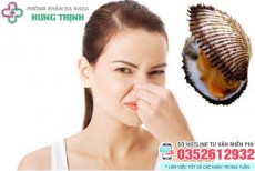 Vùng kín có mùi hôi khắm nhưng không ngứa là dấu hiệu gì?