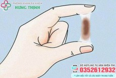 Vùng kín ra dịch màu nâu đen không mùi là bị làm sao?