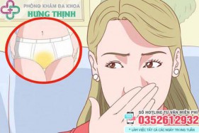 Tại sao đáy quần lót có màu vàng? Khí hư làm vàng quần lót?