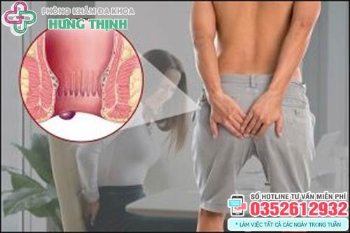 11 Cách làm co búi trĩ ngoại tại nhà teo xẹp trĩ nhanh