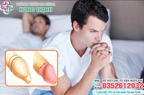 9 Địa chỉ cắt bao quy đầu ở đâu tốt nhất Hà Nội an toàn uy tín