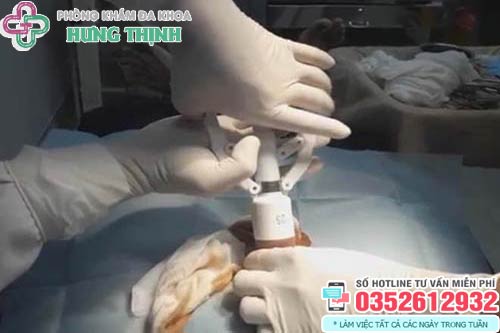 Chi phí cắt bao quy đầu ở Hà Nội hết bao nhiêu tiền
