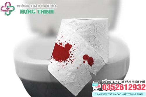 Đại tiện ra máu khám ở đâu? 10 Địa chỉ khám đi cầu ra máu ở Hà Nội